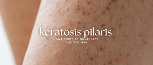 Keratosis Pilaris Treatment: The Best Routine for Smooth, Bump-Free Skin